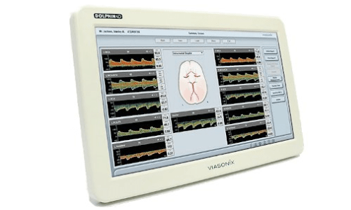 Doppler Transcranico Multifocale