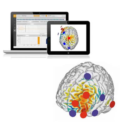 Software NIC Stim
