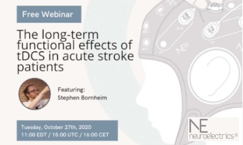 NE webinar tDCS stroke big