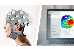 software starstim per stimolazione elettrica