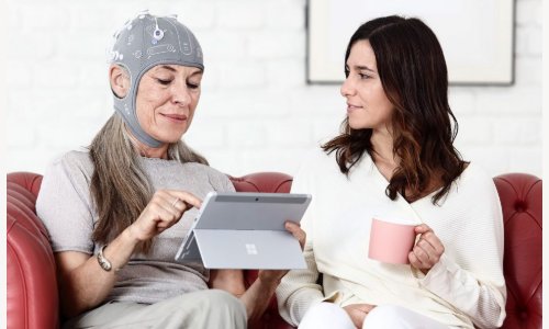 tDCS NE15maggio2020