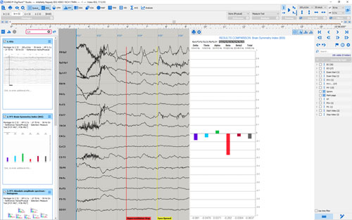 SW EEG coda stampa