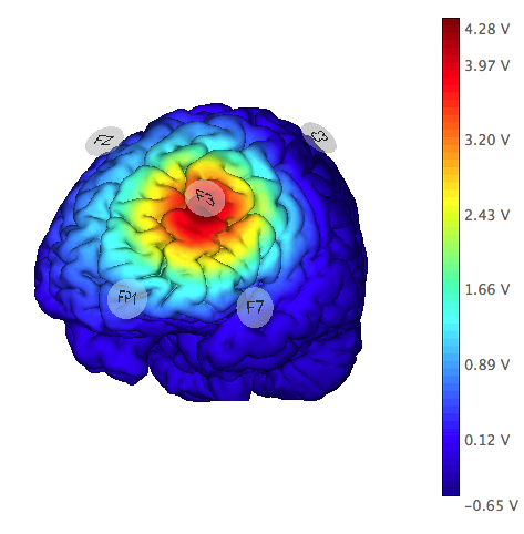 NIC2 hdtdcs montage