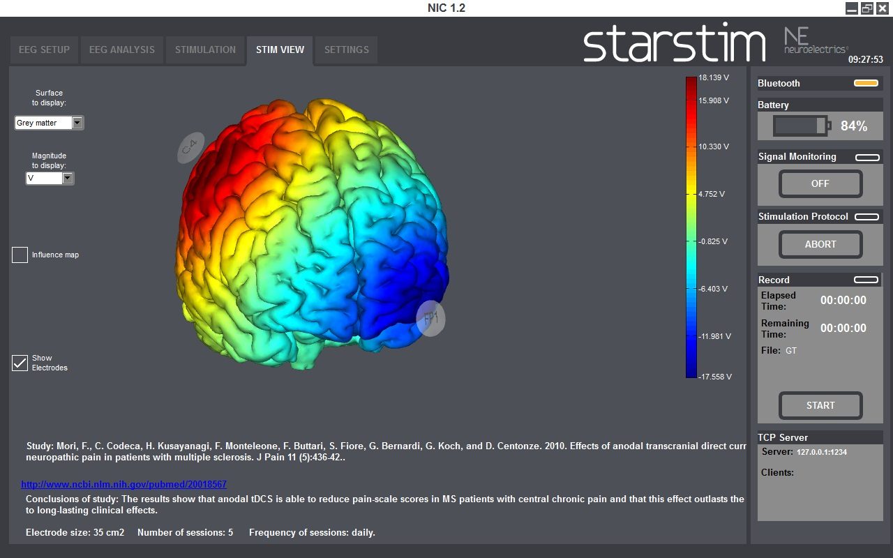 Softwrae NIC per la gestione Starstim