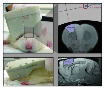 rat coilTMS