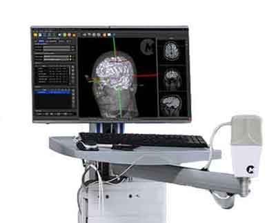 nTMS atlas
