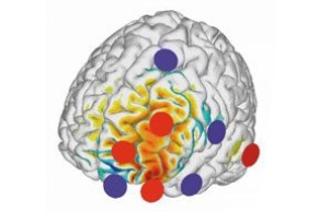 tES: adesso il protocollo di stimolazione può essere personalizzato e più efficace 